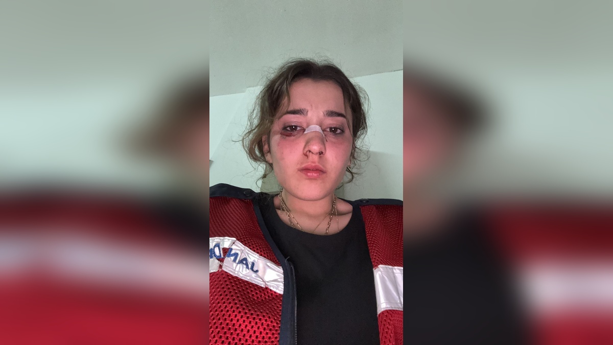 Yalova'da bayram tatilinde tartışma: Nişanlı, motosiklet kaskıyla saldırdı